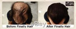 Finally Hair Building Fiber Black / Dark Brown / Medium Brown / Light Brown 399g